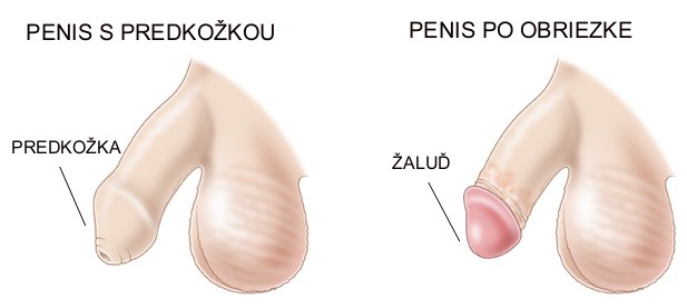 obrezaný penis 